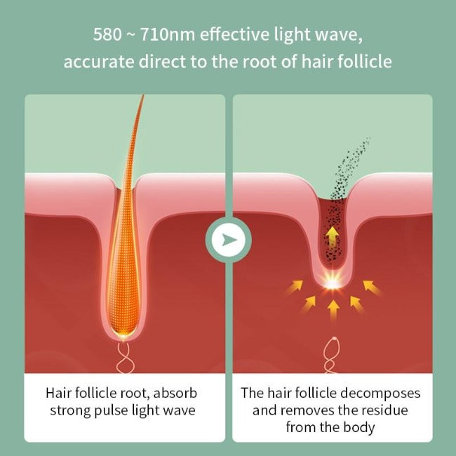 IPL Painless Laser Hair Removal Epilator - GearMeeUp