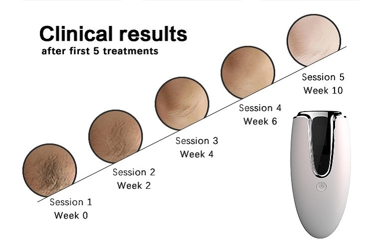 Premium IPL Painless Hair Remover - GearMeeUp