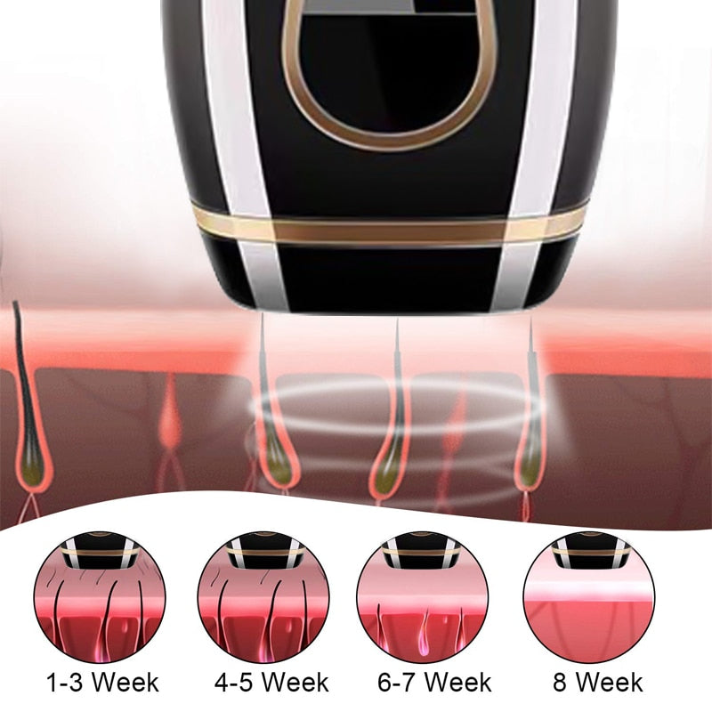 IPL Laser Hair Removal Handset - GearMeeUp