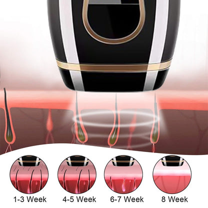 IPL Laser Hair Removal Handset - GearMeeUp